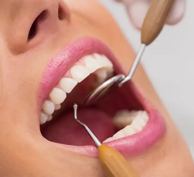 Tooth removal by Dr Karthryn Bell